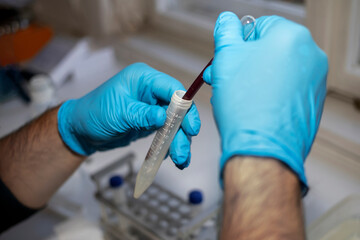 A scientist processes blood samples in a biochemical laboratory