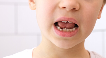 Fototapeta premium Child shows his loose milk tooth presses and pushes it with his tongue. Open mouth close-up. Caucasian 6 year old kid in a white T-shirt on a bathroom background. lower incisor. Copy space. Body part