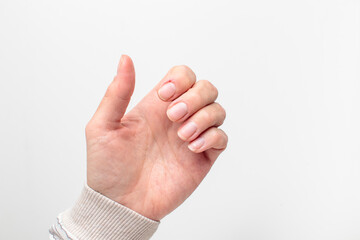 Obraz premium Closeup of hand with deformed nails and torn, ripped and picked on cuticle skin peeling off from human nail biting behavior