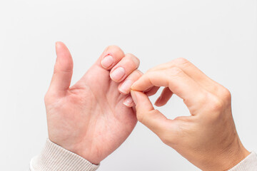 Closeup of hands with deformed nails and torn, ripped and picked on cuticle skin peeling off from human nail biting behavior