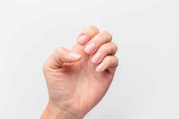 Closeup of hand with deformed nails and torn, ripped and picked on cuticle skin peeling off from human nail biting behavior