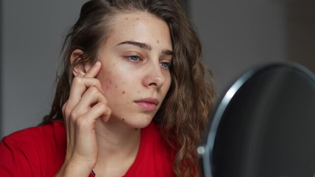 The concept of beauty and naturalness. A young woman examines her rashes on her face, touches her skin with her hands while looking in the mirror. Facial care. Acne.