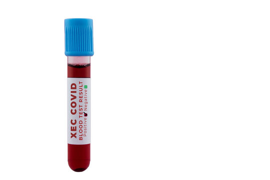 A test tube filled with blood labeled xec covid blood sample isolated on a white background.

