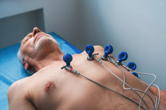 ECG electrodes on patient in hospital