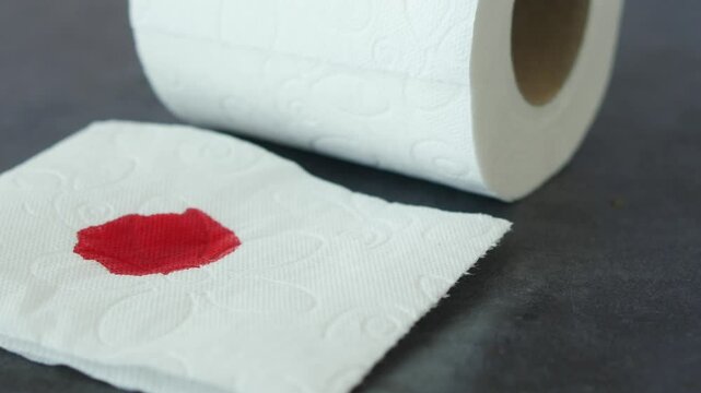 A blood spot is noticeable on a tissue next to a roll of toilet paper in the background
