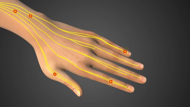 Numbness and tingling in hand