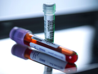 Blood vials and DNA samples used for medical testing and research.