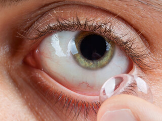 Woman putting contact lens in her eye