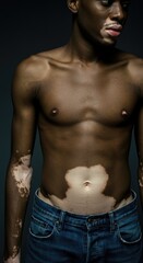 Naklejka premium Athletic African American Man with Vitiligo on Dark Background