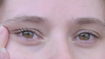 close up part of female face, woman 30-35 years old looks carefully examines wrinkles around eyes, skin folds, age-related changes, aesthetic injection cosmetology, care anti-aging procedures