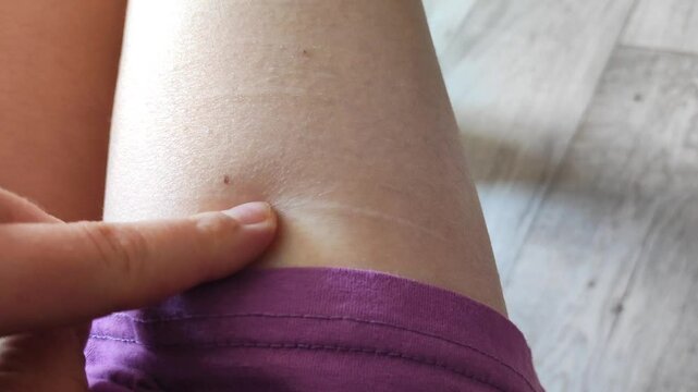 self-harm, auto-aggression and self-harm, mental health and mental illness