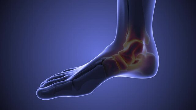 Pain and edema in the sprained ankle
