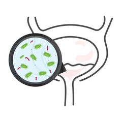 Urinary tract infection(UTI) vector. Illustration of infect the urinary tract.