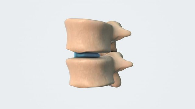 Incompressible Gel Supports Vertebral Rolling in Nucleus