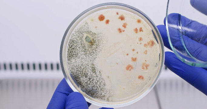 Analysis of bacterial growth in mold contamination. A scientist opens a petri dish where bacteria and black mold have grown. 
