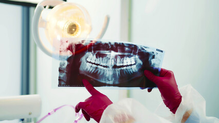 Dentist examining dental X-ray. A close-up shot of a dentist holding a dental X-ray image under a...