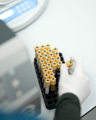 Gloved physician takes vial of blood plasma to laboratory for testing. Tray of blood tubes. 