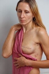 Woman portray resilience after breast surgery, hold pink cloth