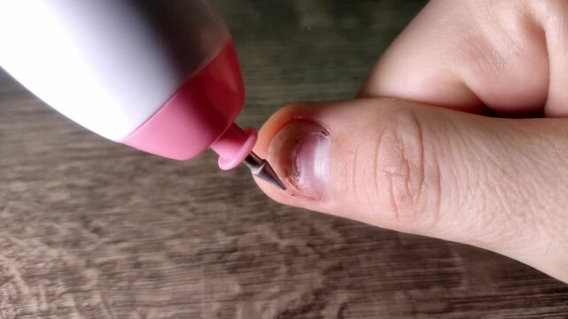 A manicurist restores a damaged broken nail on a finger. Nail fungus. Nail restoration, manicure