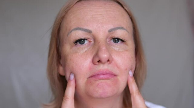 Portrait the fingers holding the flabbiness adipose sagging skin, Flabby skin and loose, swelling and ptosis beside the eyelid, dark spots and wrinkle on the face, health care and beauty concept.