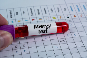 Test tube with blood sample for food allergy test