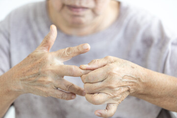 Senior woman with Trigger finger disease,pain in hand,elderly massaging,rubbing and kneading of...