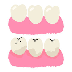 Dental caries disease vector