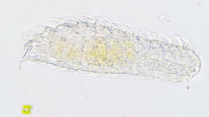 Acoelomate gastrotrichs, Chaetonotus sp. Fresh sample. Selective focus image
