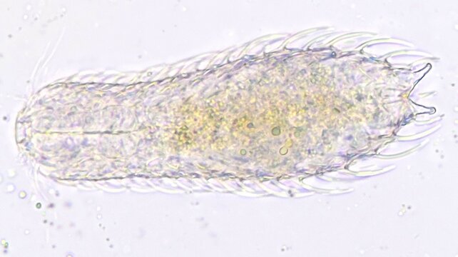 Acoelomate gastrotrichs, Chaetonotus sp. Fresh sample. Selective focus image