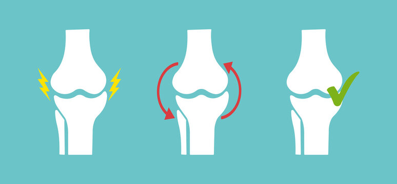 Knee joint concept. The disease of the disease, the treatment of the disease, the prolongation of the disease. Chondroprotectors, physiotherapy, exercise therapy. Vector design