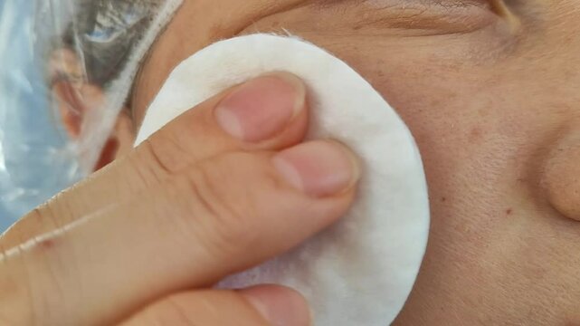 A woman rubs her face with a cotton sponge and moisturizes her skin with medicinal cream. Age pigment stains, dark sun spots. Cosmetic procedure, hygiene and care. Simple video.