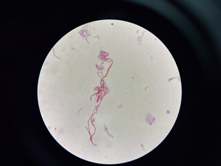 Bacteria cell in hemp culture