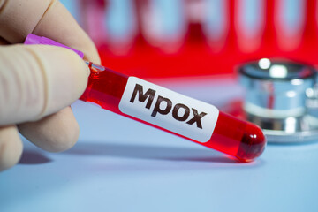 Blood collection tubes Mpox test positive results,WHO to rename monkeypox as ‘Mpox’