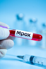 Obraz premium Blood collection tubes Mpox test positive results,WHO to rename monkeypox as ‘Mpox’