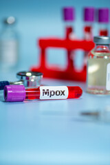 Blood collection tubes Mpox test positive results,WHO to rename monkeypox as ‘Mpox’