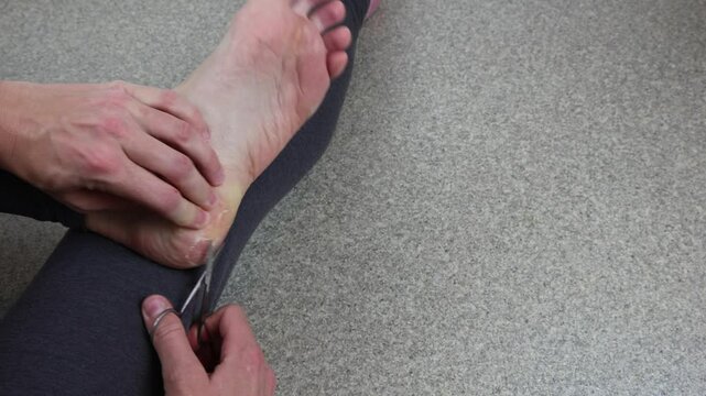 Cutting off blisters and calluses on the heel, foot care