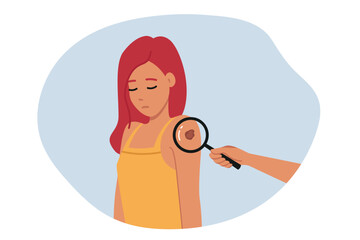 Melanoma or malignant tumor found on shoulder of woman standing near magnifying glass. Girl with cancer suffers from melanoma caused by bad climate or hereditary disease inherited from parents