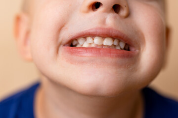 Close-up of a smiling child with a joyful face, with a soft beige background 