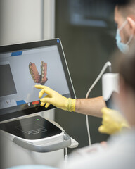 dentist uses intraoral scanner to create 3D digital model of patient's mouth. The screen displays 3D scan of jaw, allowing precise digital impressions for better treatment planning.