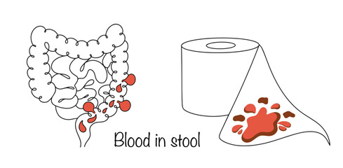 Blood in stool
