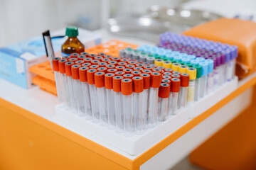 Close-up of laboratory test tubes with colorful caps, medical, scientific, and healthcare topics
