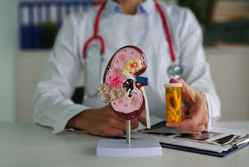 Nephrologist doctor holds in hands an anatomical model of human kidney with pills in clinic