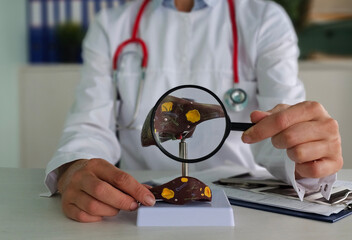 Anatomical liver with gall bladder and pancreas and magnifying glass in hands of a doctor