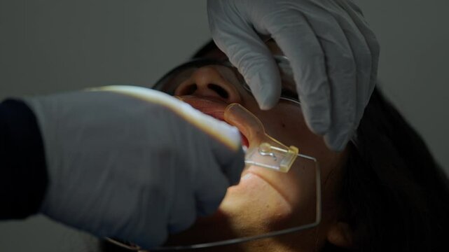 Male Latino orthodontist placing a dental cheek retractor on a female patient