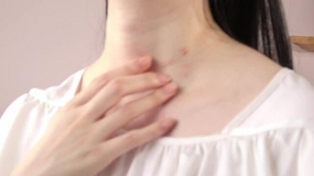 Closeup shot of a young woman scratching her neck. Itchy body with skin problem. 4K