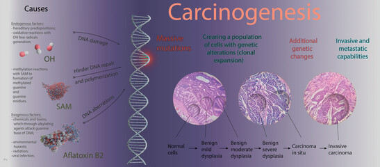 infographic of cancerogenesis, 3d illustration