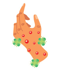 young man with monkeypox virus infection