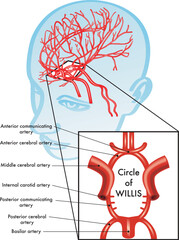 Medical illustration showing the location of the Circle of Willis in the brain.