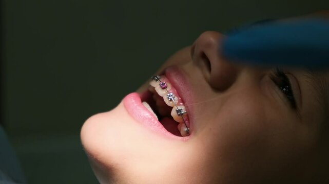 A 10-year-old girl at a dentist appointment receiving an orthodontic braces adjustment.