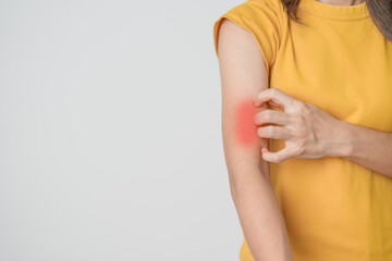 woman itching and scratching itchy arm. Sensitive Skin Allergic reaction to insect bite, food, drug...